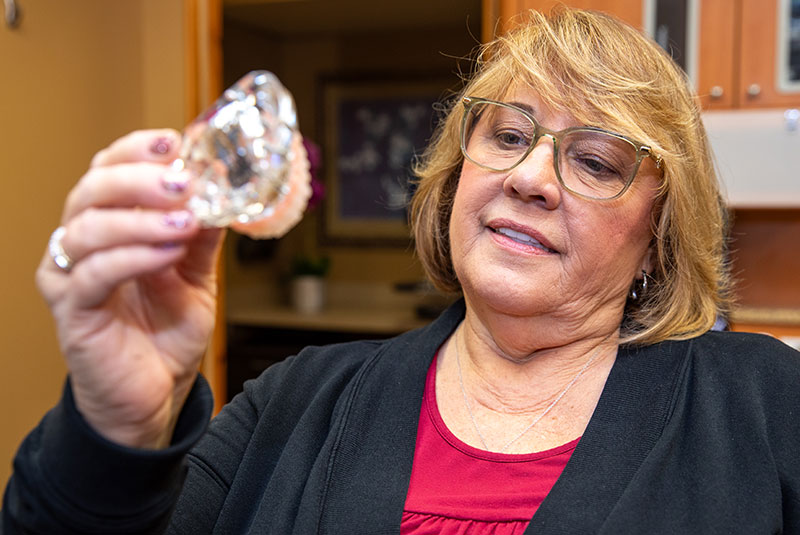 patient holding model of dental implants