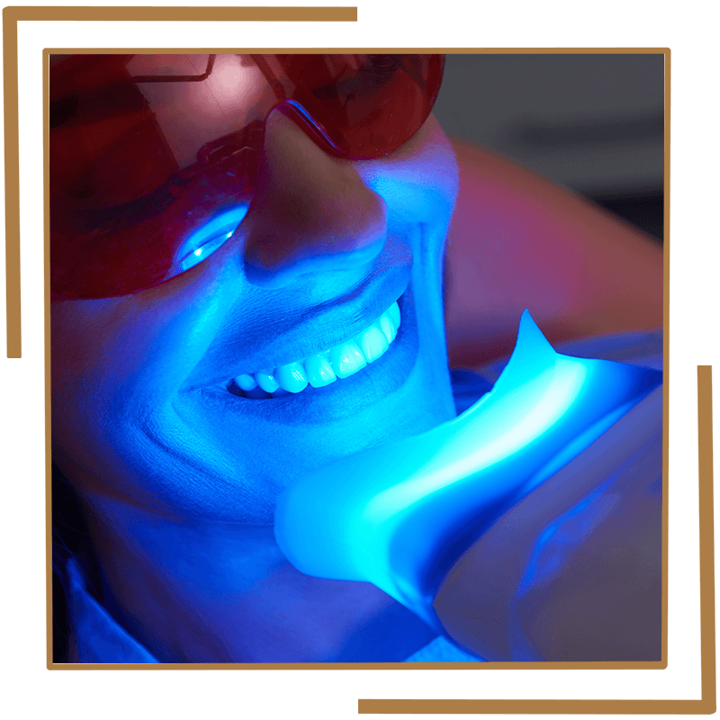 Teeth whitening
